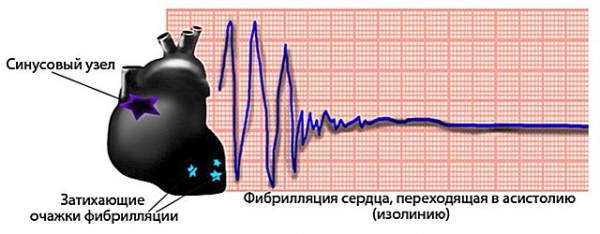 Какой ток опаснее постоянный или переменный